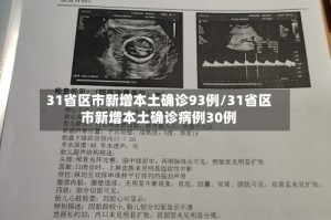 31省区市新增本土确诊93例/31省区市新增本土确诊病例30例