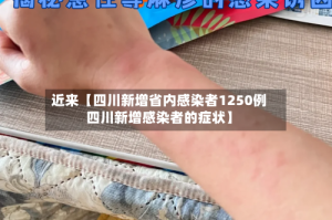 近来【四川新增省内感染者1250例四川新增感染者的症状】