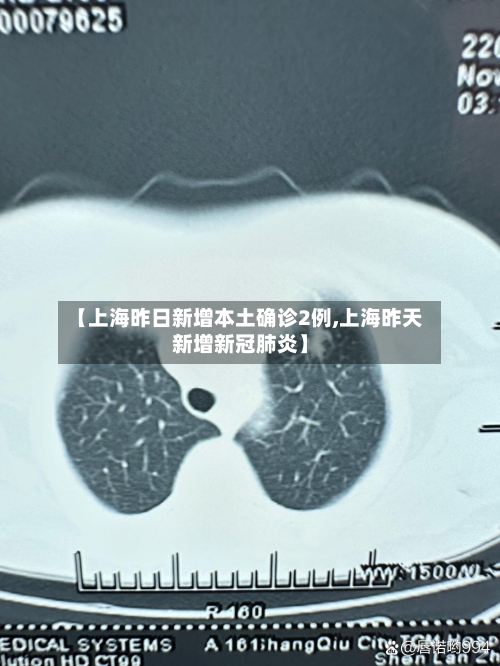 【上海昨日新增本土确诊2例,上海昨天新增新冠肺炎】-第1张图片