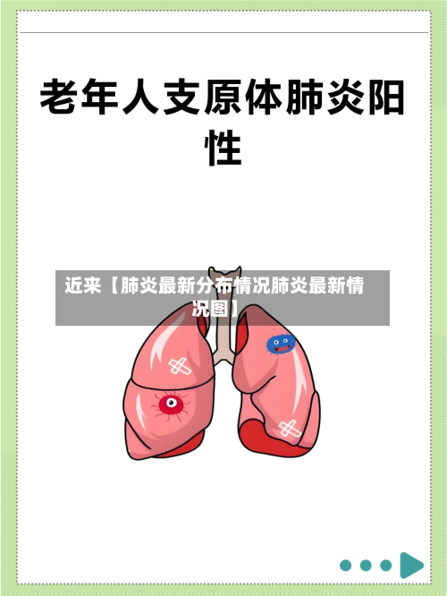 近来【肺炎最新分布情况肺炎最新情况图】-第1张图片